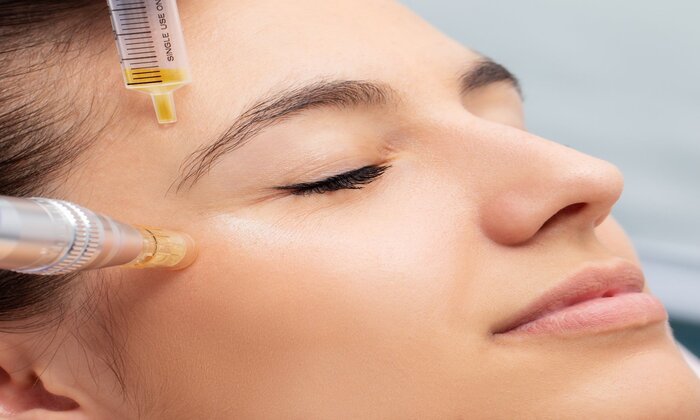 PRP for Skin Repair