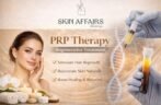 Skin Care Treatment Near Me – 7 Powerful Benefits of PRP Therapy for Naturally Radiant Skin