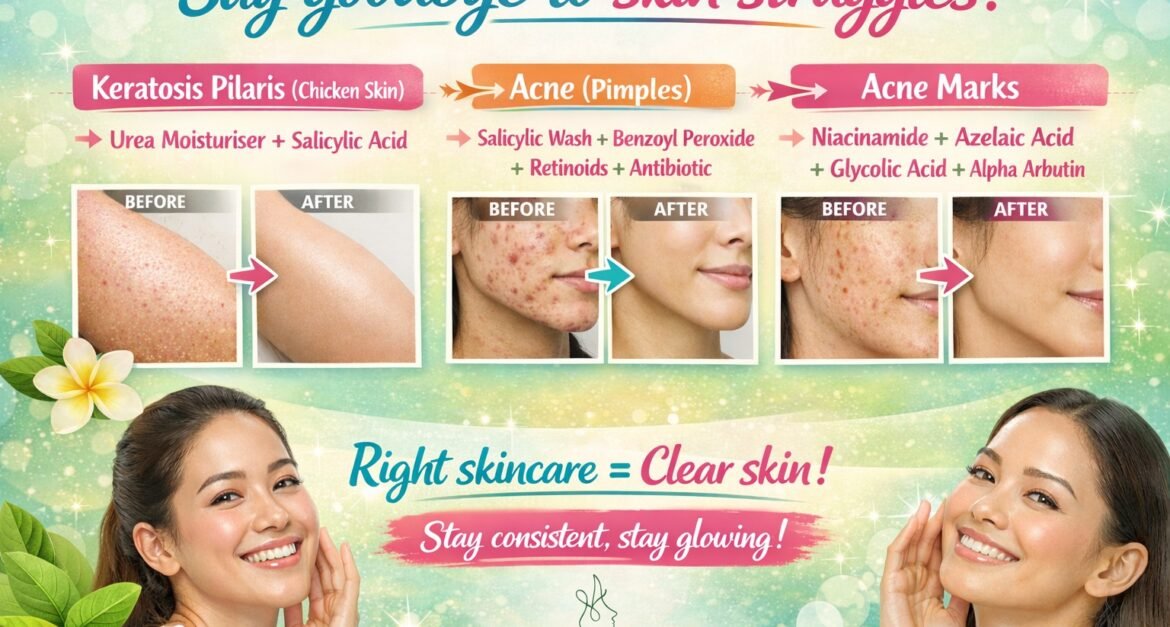 Near by skin specialist treating acne and pimples professionally