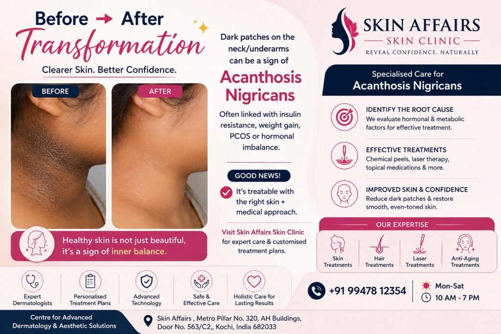 Acanthosis Nigricans treatment in Kochi